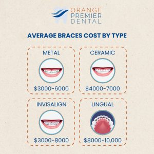 Cost Of Braces