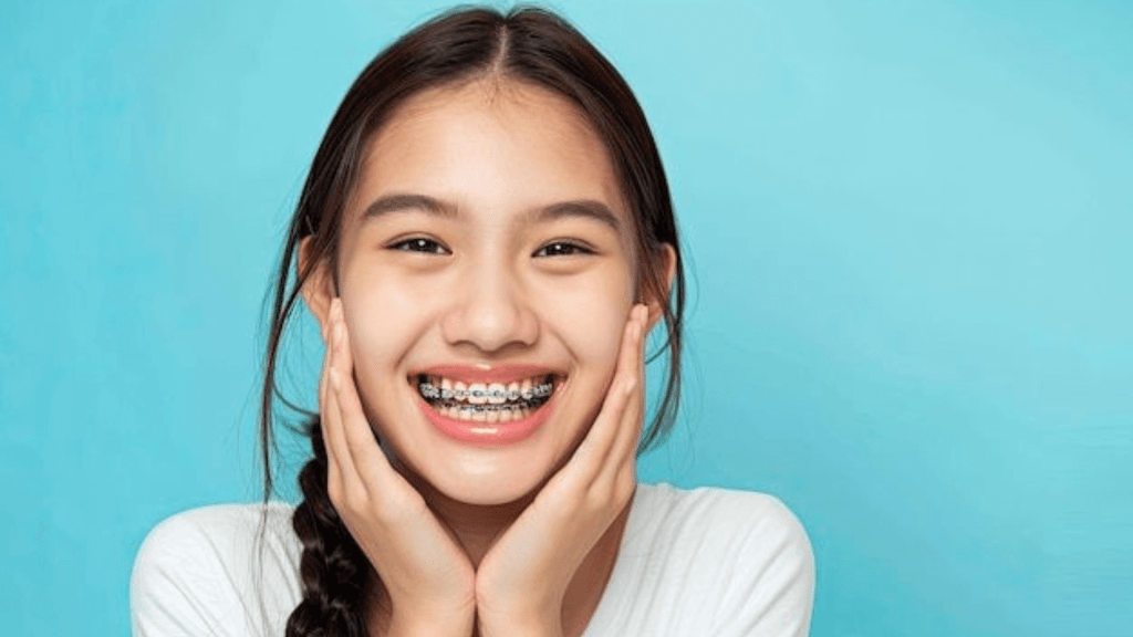 Braces Cost