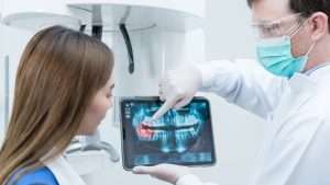 Dental X Ray